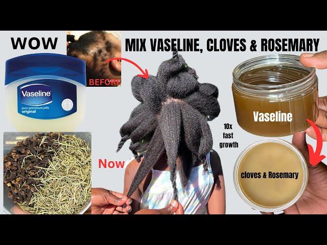 WOW  Mix VASELINE with CLOVES & ROSEMARY &  Grow Hair Like Never Before 10x FASTER.