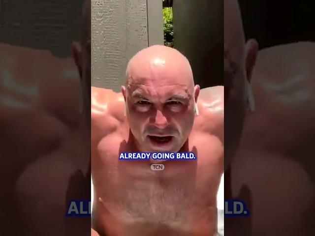 Should You Go Bald if You’re Losing Hair?