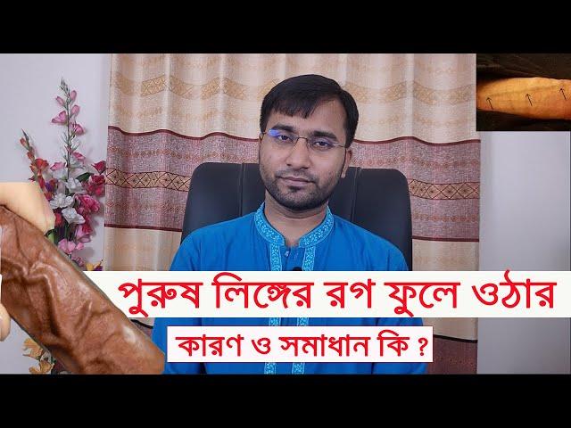 পেনাইল ভেরিকোজ ভেইন/ পুরুষাঙ্গের রগ ফুলে যাওয়ার কারণ ,লক্ষন ও সমাধান কি জেনে নিন