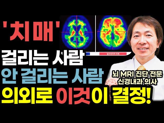 80살 90살 100살 나이 들어도 치매 안 걸리고 최고의 기억력을 유지하는 방법 / 뇌 MRI 1만 장 분석하고 발견한 의사도 깜짝 놀란 최고의 치매예방 습관 / 뇌과학 뇌건강