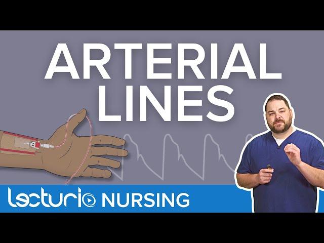 Arterial Lines: Placement Locations & Line Pressure Monitoring | Lecturio Critical Care Nursing