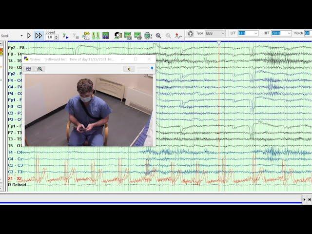 Electroencephalogram