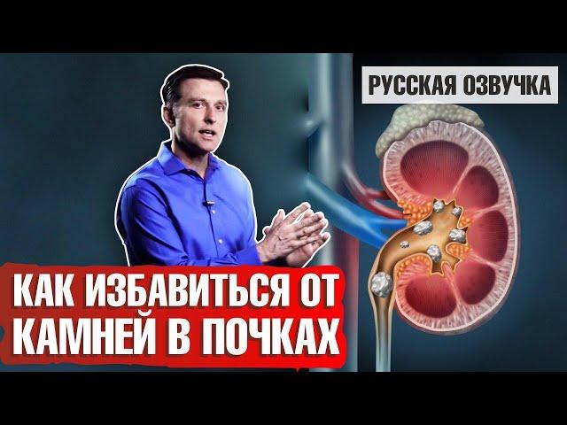 Камни в почках: Как избавиться? (русская озвучка)