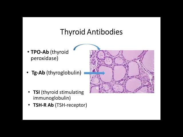 2016: Interpreting Abnormal Thyroid Function Tests & Understanding Indications for Treatment