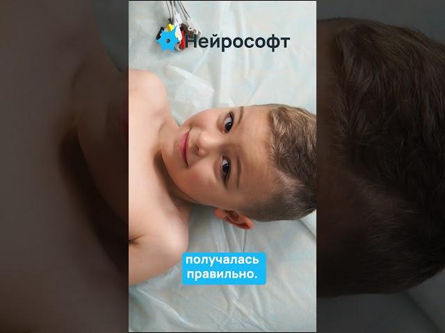 Наложение ЭКГ-электродов #ЭКГ #Нейрософт