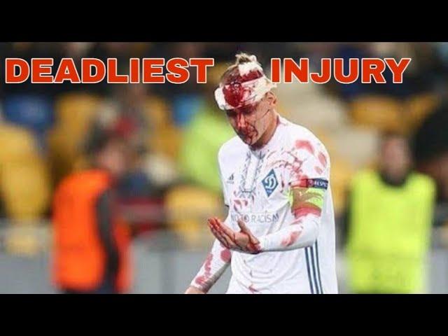 The most DEADLIEST head injury in football [Domagoj Vida ]