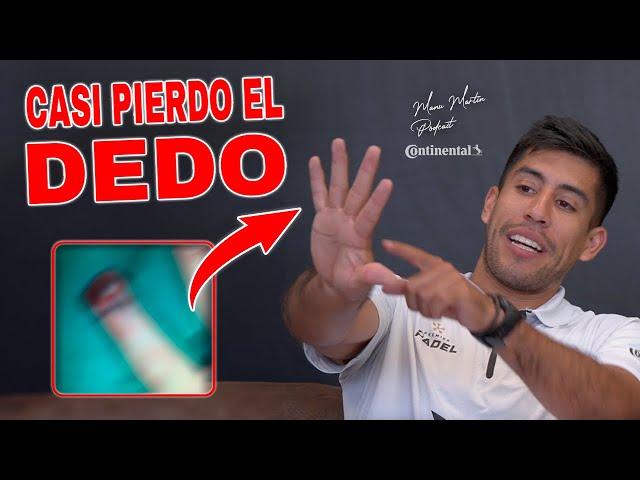 FEDE CHINGOTTO: El PADEL es un DEPORTE DE RIESGO, perdí 3 dientes por un GOLPE y casi PIERDO EL DEDO