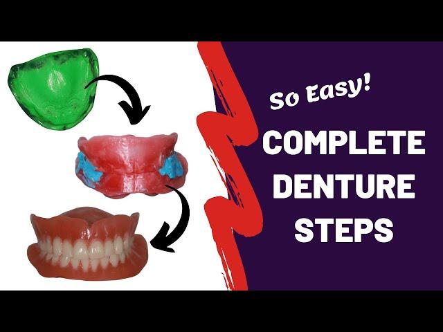 Complete Denture Steps #prosthodontics