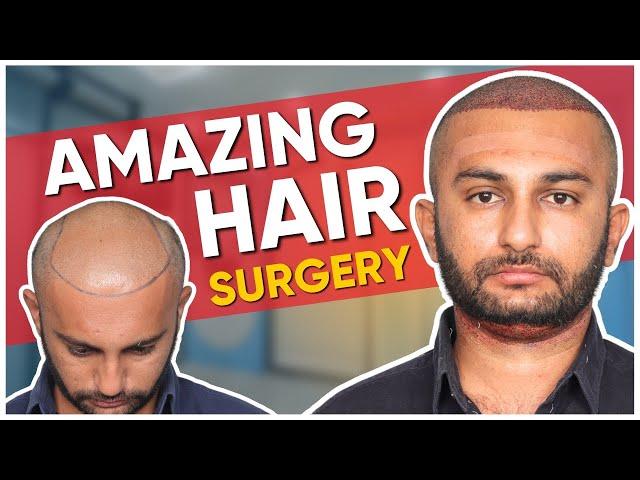 Hair Transplant in Ahmedabad | Best Results & Cost of Hair Transplant in Ahmedabad