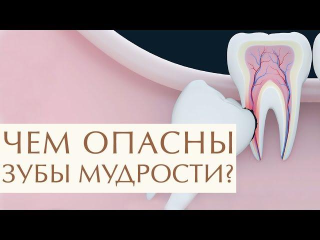  Для чего нужны зубы мудрости, стоит или нет их удалять. Удалять или нет зуб мудрости. 12+