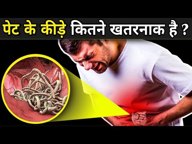 इन रोज की गलतियों से हो जाएंगे पेट के कीड़े | Stomach Worms Symptoms