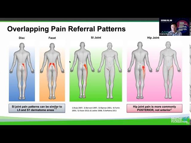 Sacroilliac Joint Dysfunction: Diagnosis & Treatment - Stephen Ryu, MD