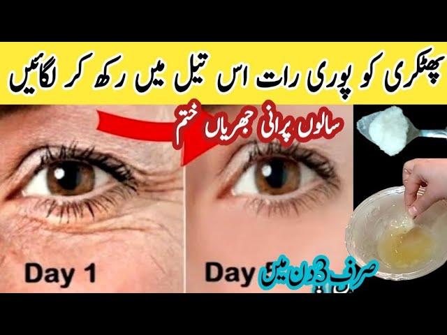 Alum Magic To Get Rid Of Wrinkles | Alum (Phitakri) For Skin Tightening| Minimize Open Pores