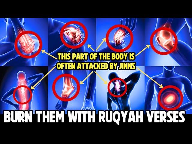 RUQYAH destroys the jinn that live in the nose and head | Maged Aldaoos ماجد الدعوس