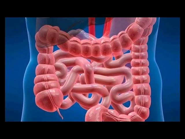 SÍNDROME DE COLON IRRITABLE COLITIS CRÓNICA CAUSAS SÍNTOMAS TRATAMIENTO DATOS CLÍNICOS