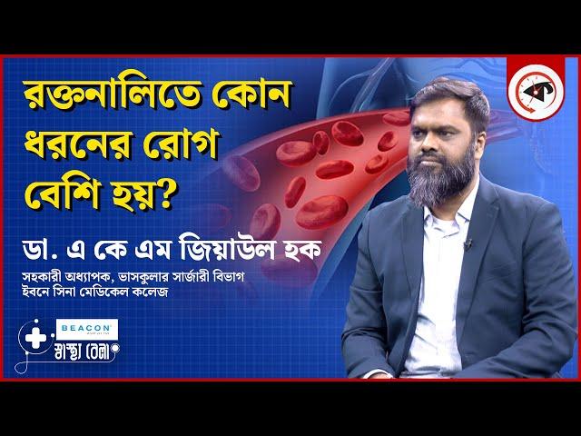 রক্তনালিতে কোন ধরনের রোগ বেশি হয়? | Blood Vessels Diseases | Dr. AKM Ziaul Huque | Sasthobela