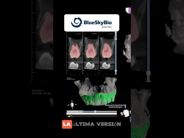 BlueSkyBio #shorts #bluesky #blueskybio #blueskybiodigital #odontologiadigital #odontologia