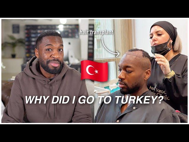 Why I Chose Turkey for My Hair Transplant ….SHOULD YOU?!