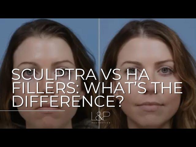 Fall Into Beauty 2022: Sculptra vs. HA Fillers - What's The Difference?