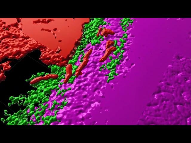 Complexity of tumors revealed in 3D