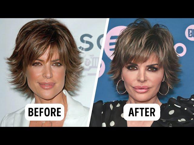 How Cosmetic Procedures Changed 15 Famous Women