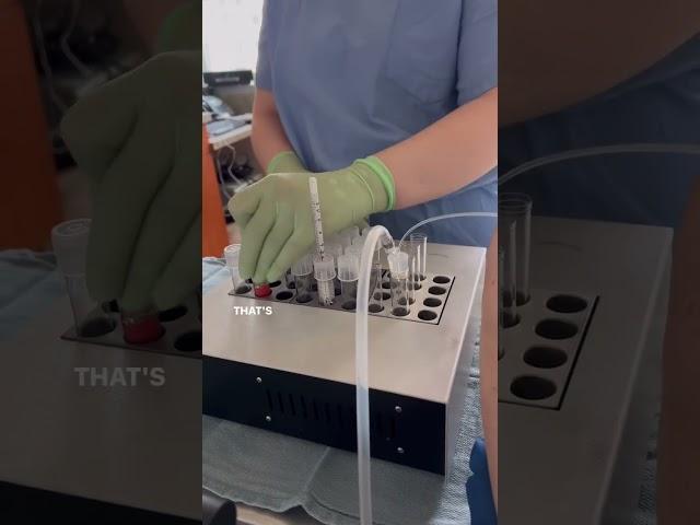 Watch An Egg Retrieval #eggretrieval #drlorashahine #fertilityspecialist #shorts