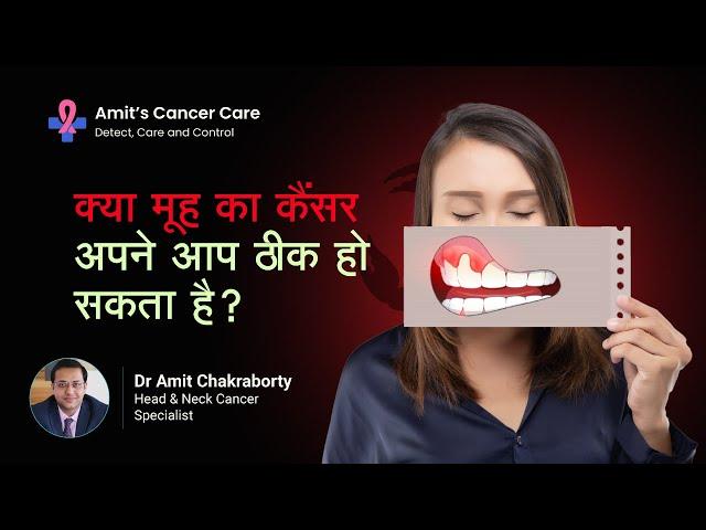 क्या मूह का कैंसर अपने आप ठीक हो सकता है? | Can mouth cancer get cured on its own? |  Dr Amit C