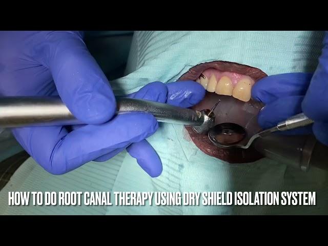 How To Do Root Canal Using Wave One Endo System and DryShield Technology #waveone#dryshield