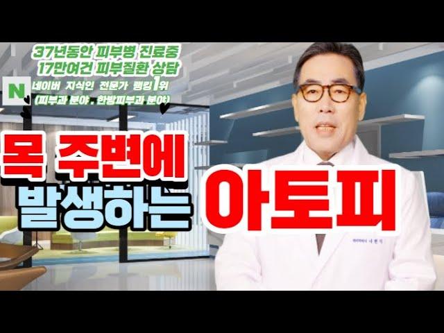 4K)목부위 목부위 아토피의 원인과 치료 방법은?아토피의 증상과 음식은?