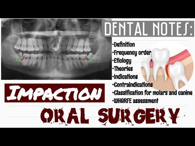 IMPACTION || ORAL SURGERY || DENTAL NOTES