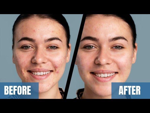 How to Use the Healing Brush Tool in Photoshop | Best Photoshop Tutorial | @BeingMuradShabir