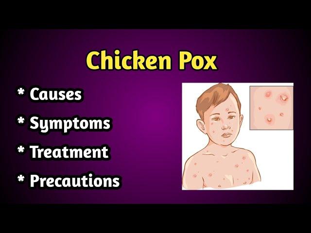 Chicken Pox causes, Symptoms and Treatment