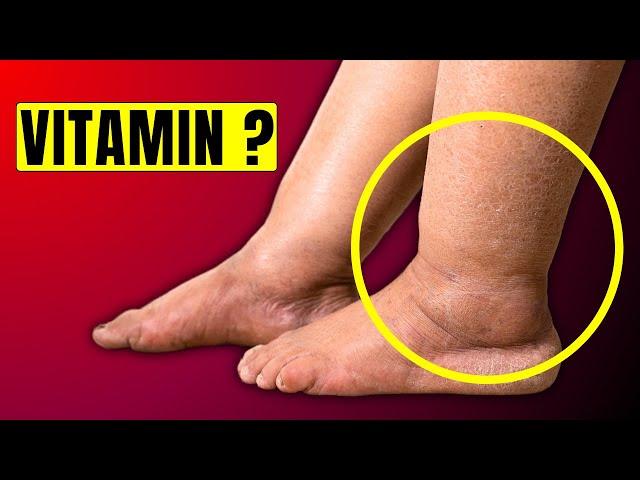 #1 Vitamin to Eliminate Swelling in Feet and Legs | HealthQuest