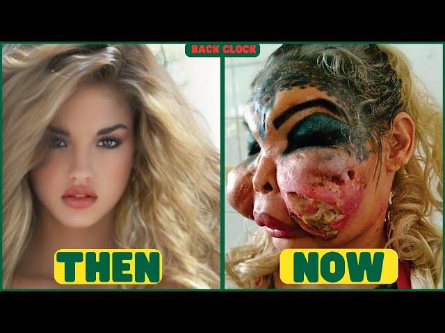 Famous Celebrities Unrecognizable After Plastic Surgery Gone Wrong | Then and Now 2024