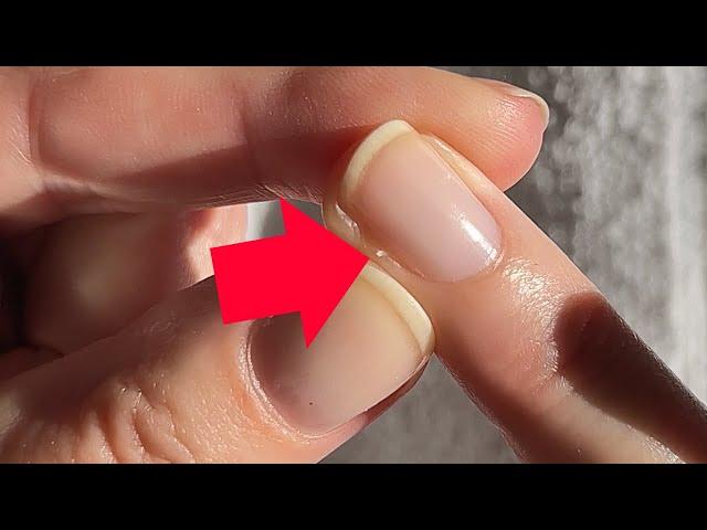 How to remove a hangnail like a PRO! [Pro Nail Technician Explains]