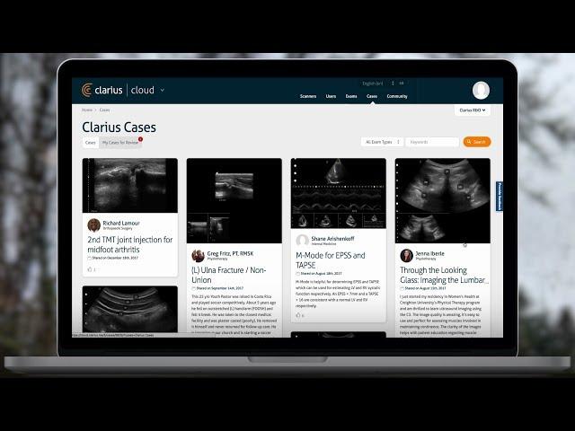 How to Use Clarius Cloud | Handheld Ultrasound Using Smartphones and Cloud | Clarius Ultrasound