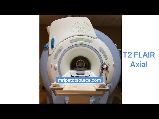 Specialized Brain MRI Scan Sounds Inside Scan for Brain Shunt