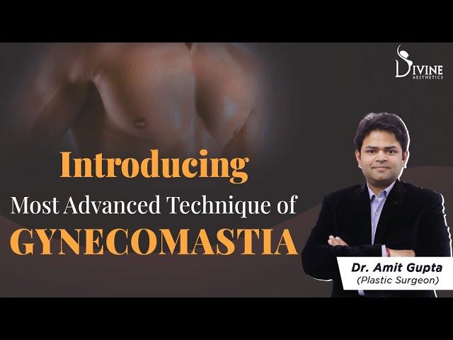 Introducing the  Most Advanced Technique of Gynecomastia | Dr. Amit Gupta