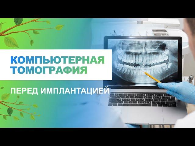   Компьютерная томография зубов перед имплантацией