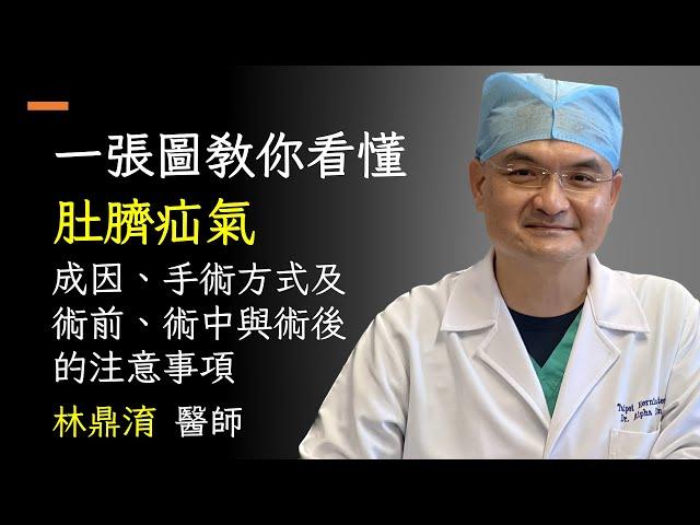 肚臍膨脹別亂壓！臍疝氣的發生原因?需要動手術嗎？臍疝氣有那些治療方式？