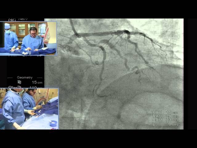 Part 1: Complex PCI Case - Patient Presentation and Access