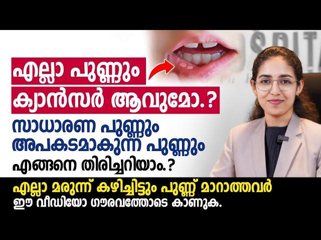 വായയിൽ പുണ്ണ് ഉള്ളവർ ഈ ഈ വീഡിയോ കാണുക| പുണ്ണ് ക്യാൻസർ ആവുന്നത് എപ്പോൾ? #വായ്പുണ്ണ്