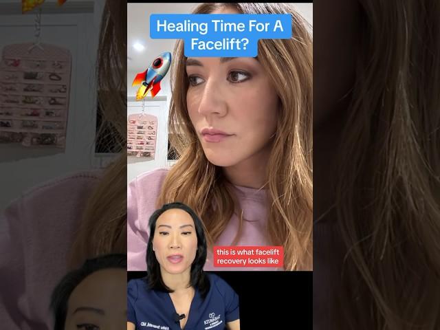 ⏰ HEALING TIME FOR FACELIFT?! (BEFORE AFTER)