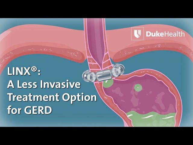 Using LINX® to Treat GERD  | Duke Health