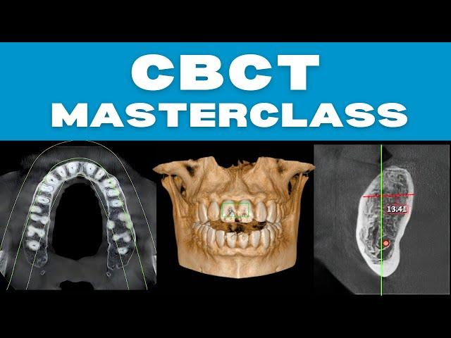 CBCT Masterclass (With Real Case Discussions)