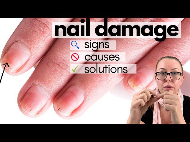 You took off Acrylics, Gels or Dip nails and discovered DISASTER. What's next?