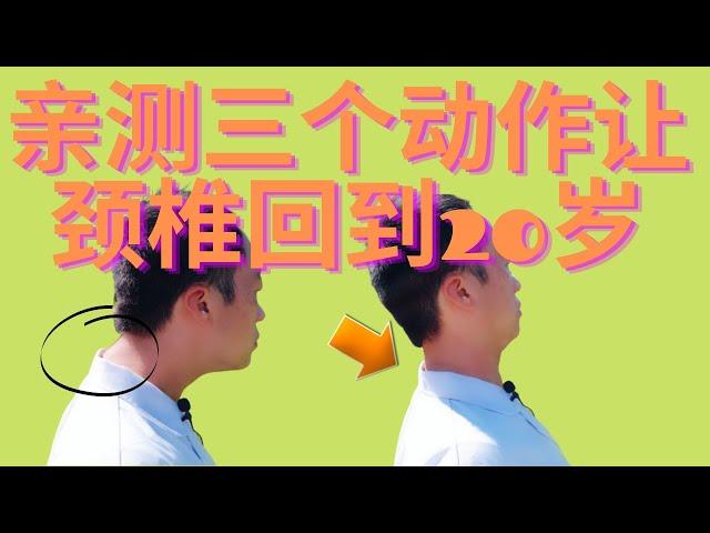 三个动作彻底摆脱颈椎病，脖子酸痛！颈椎病的危害超乎你的想象！原来高血压，富贵包，头晕，头痛，失眠，脑供血不足都和颈椎有关！