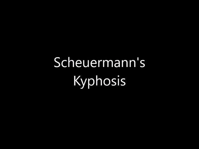 Scheuermann's Kyphosis Surgery