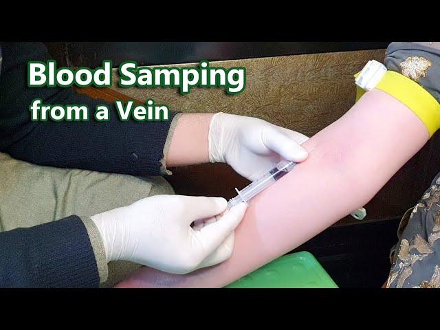 How to Take Venous Blood Sample | Venipuncture | Phlebotomy | Vein