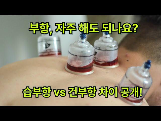 부항, 자주 해도 될까? 한의사가 알려주는 부항치료의 모든 것 #부항 #cupping #cuppingtherapy